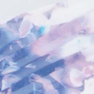 Multi Tie-Dye Dress